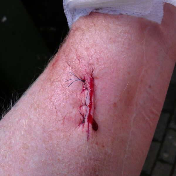 Heute im Kreiskrankenhaus gewesen…